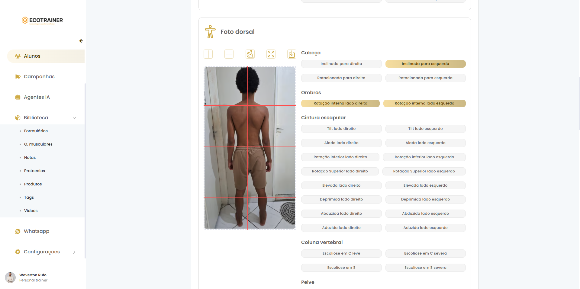 Avaliação postural no Ecotrainer com registro visual e critérios técnicos